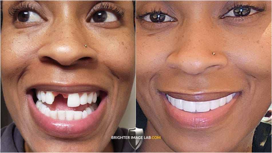 TaneaWalker-2023_image