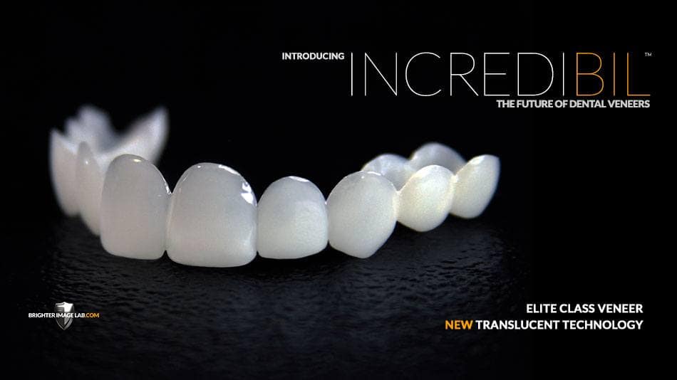 Ginger-K-2019.jpg Introducing IncrediBIL - The future of dental veneers