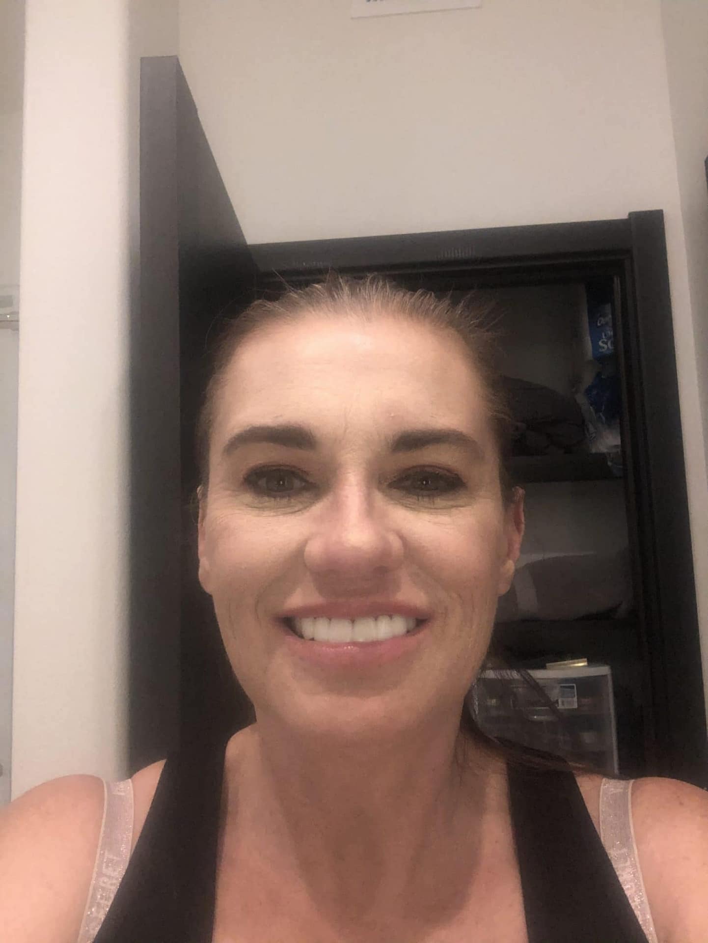 missing teeth missing teeth