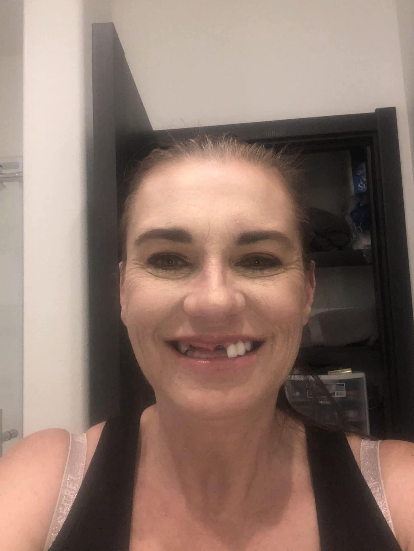 missing teeth missing teeth