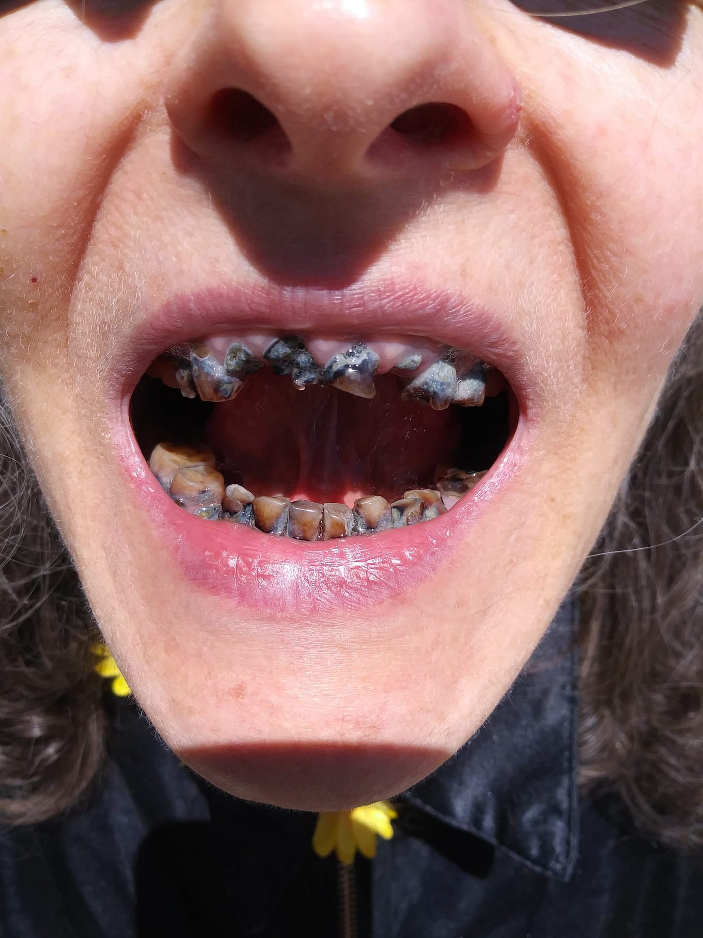 smile makeover smile makeover