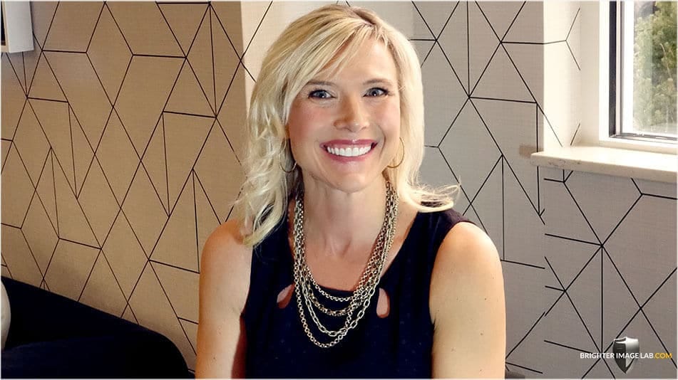 Kimberli-S-2020 instant gingivectomy