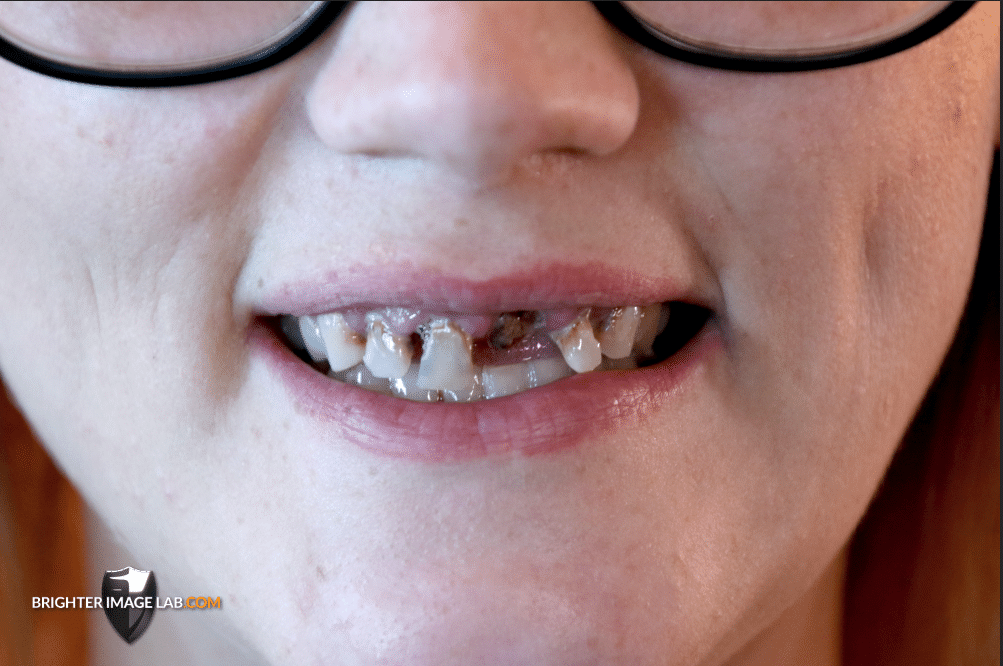 MicrosoftTeams-image (5) smile makeover