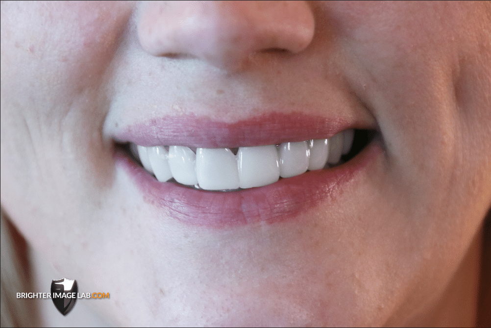 MicrosoftTeams-image (6)