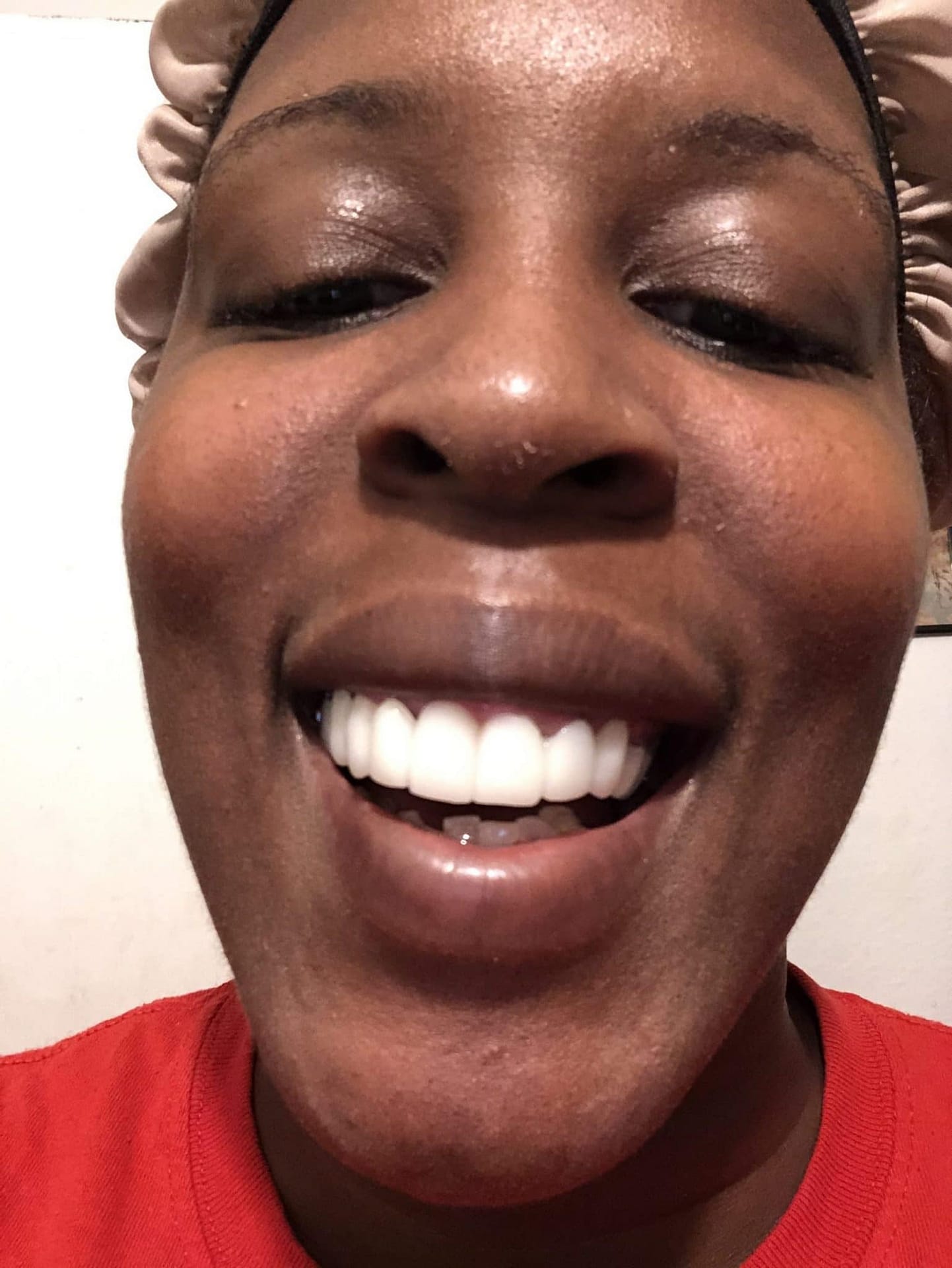 missing teeth missing teeth