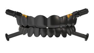 Best teeth whitening isn't found in a store! Best teeth whitening isn't found in a store!