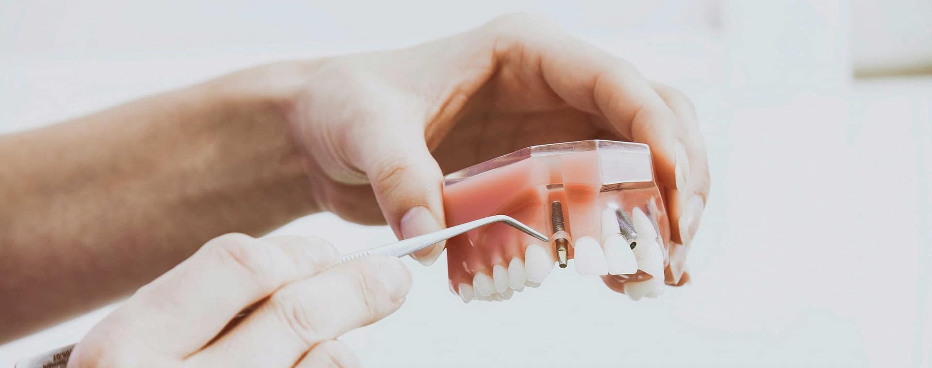 cosmetic-dentist-putting-in-screw cosmetic-dentistry-screw