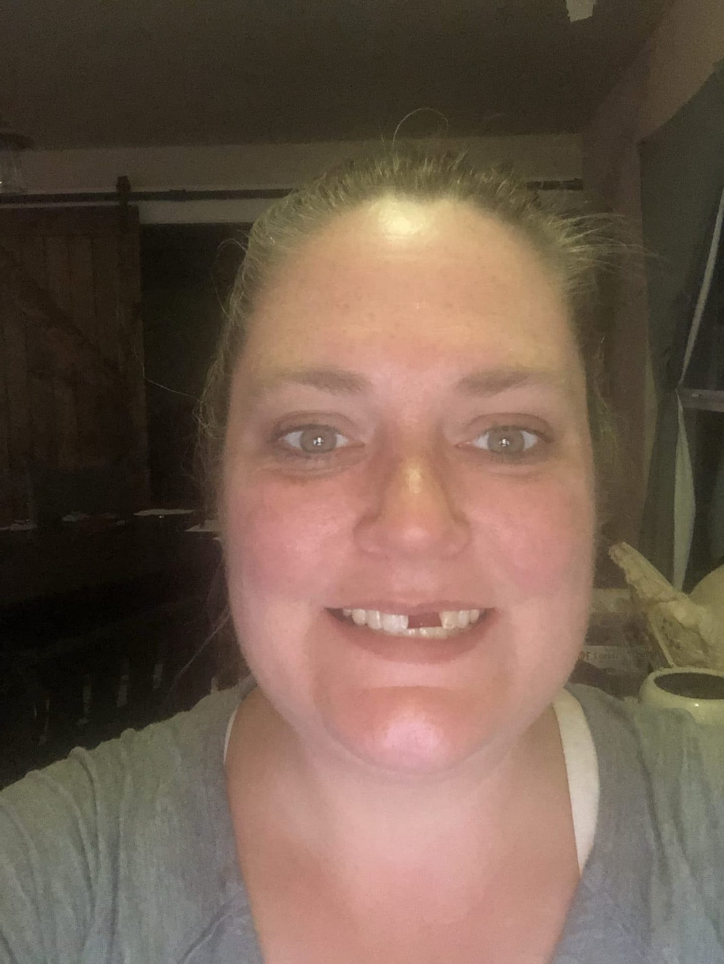 dental partials dental partials