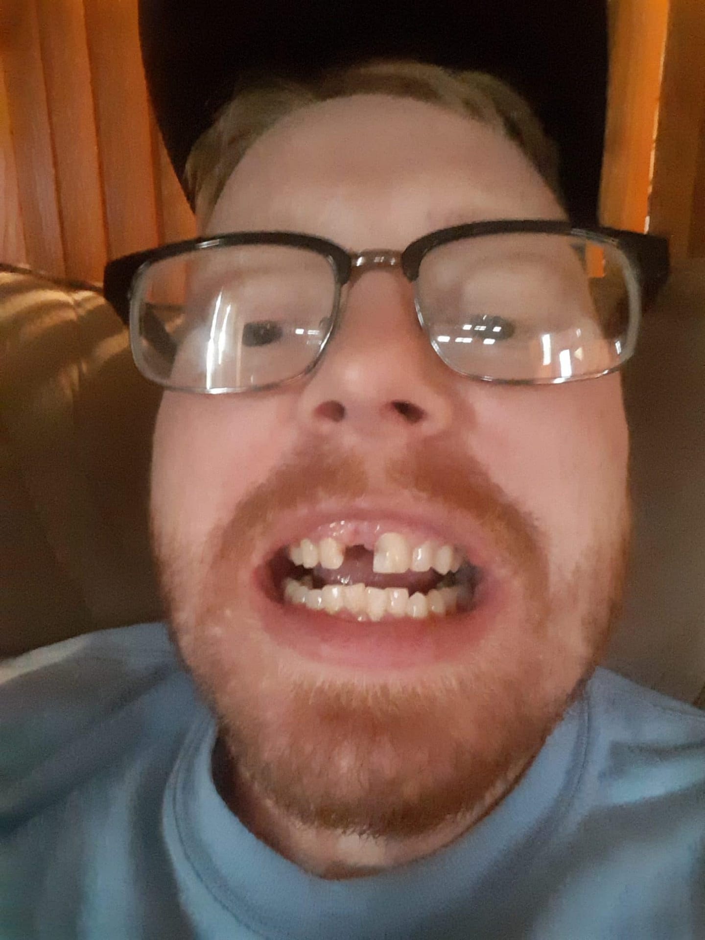 dental partials dental partials