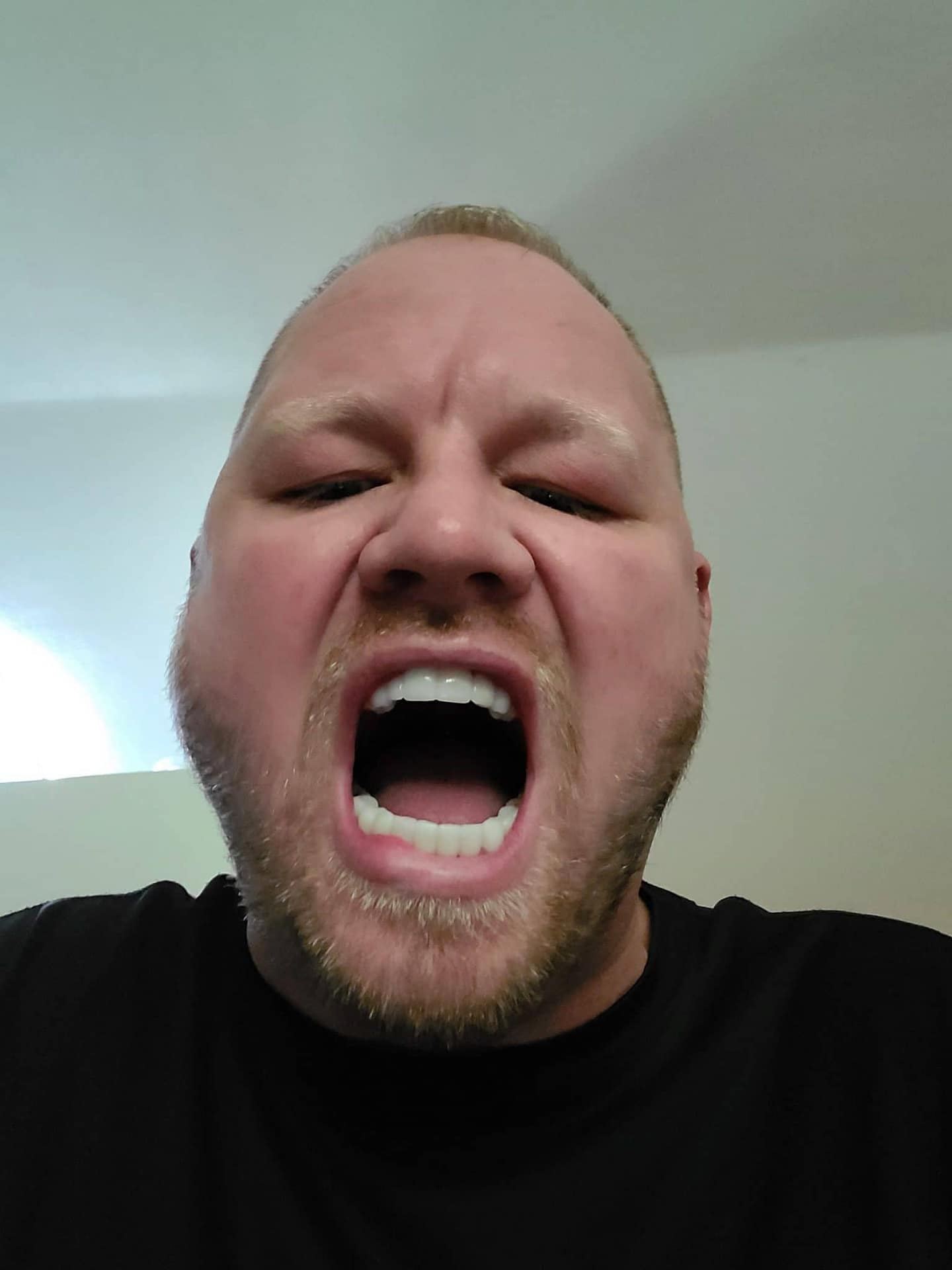 dental partials dental partials