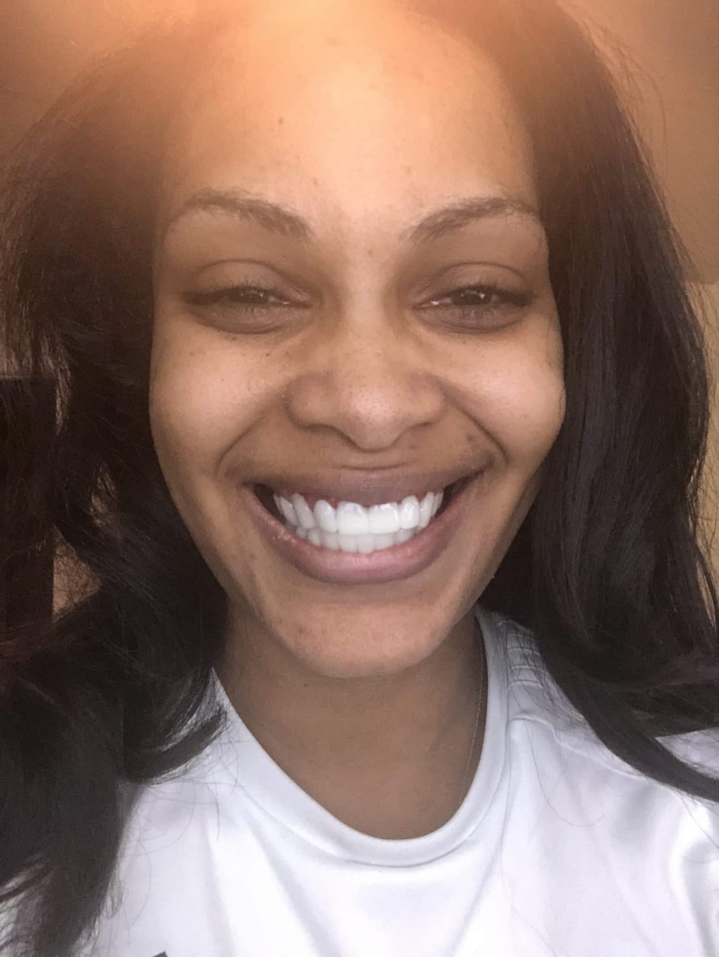 dental partials dental partials