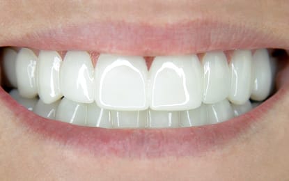 Slider-Heather-After