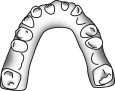 Kleine / kurze Zähne oder Schleifen