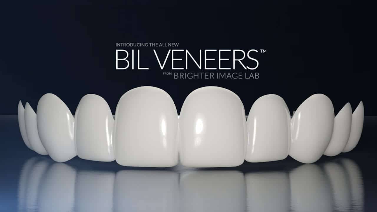 bilveneers-product-shot