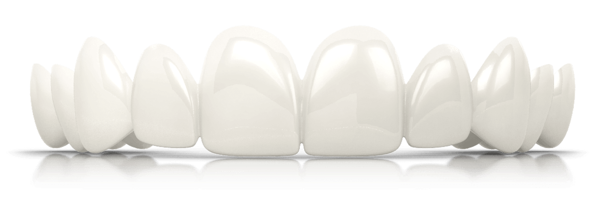Dental Veneers Alternative with BilVeneers by Brighter Image Lab