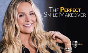 The Perfect Smile Makeover