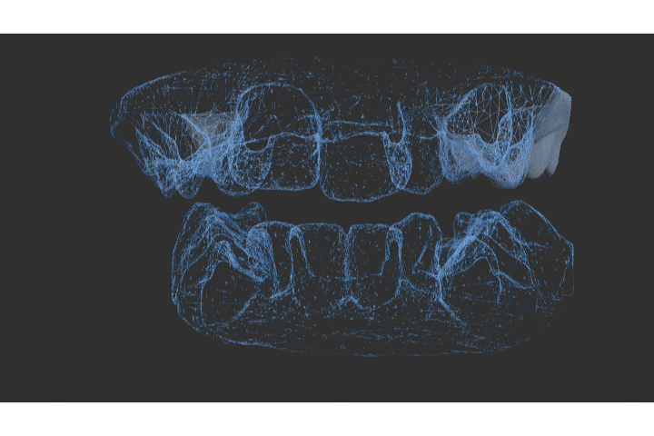 الرسوم المتحركة لقشرة الأسنان