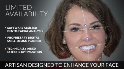 El cambio de imagen sistémico de la sonrisa - Evaluar - Planificar - Preparar - Diseñar - Crear