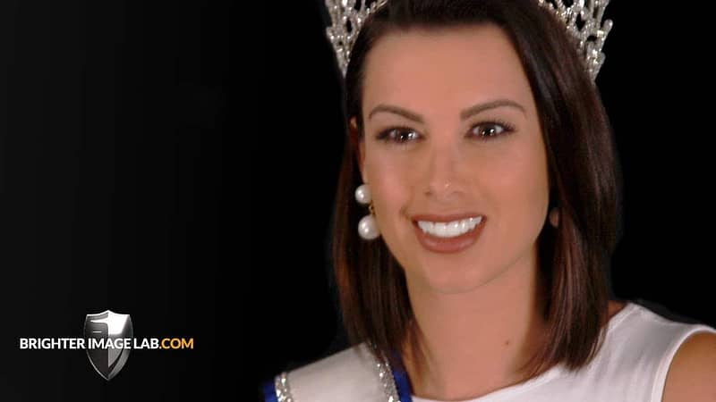 Pageant Queen krijgt nieuwe Incredibil Smile Makeover