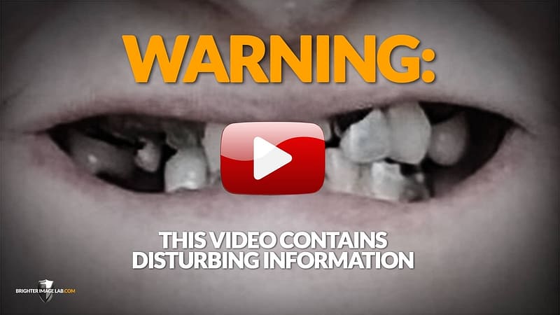 Comprador Cuidado: este vídeo contém informações perturbadoras