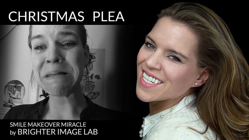 Neues Lächeln Makeover als Weihnachtswunder an Frau geliefert von Brighter Image Lab