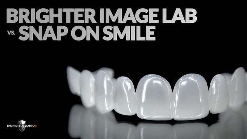 Snap On Smile custou de um dentista cosmético