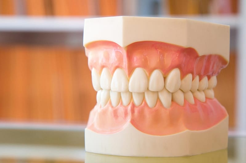 Zahnfleischlappen-Chirurgie
