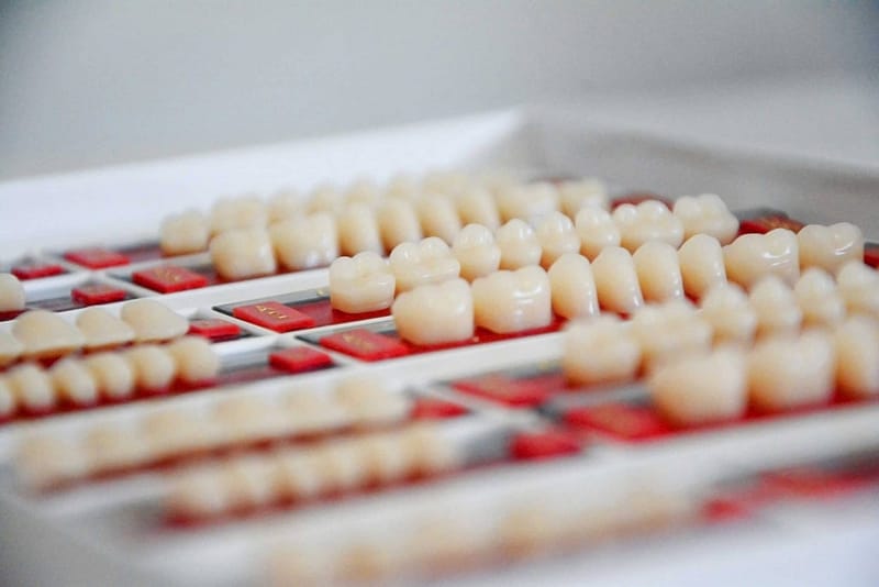 Veneers-Zähne-Vor- und Nachteile