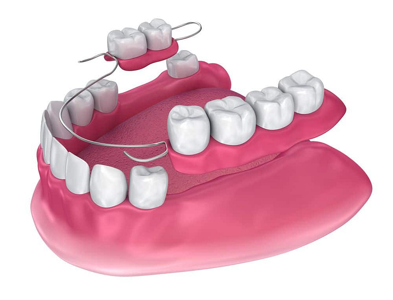 tandheelkundige gedeelten