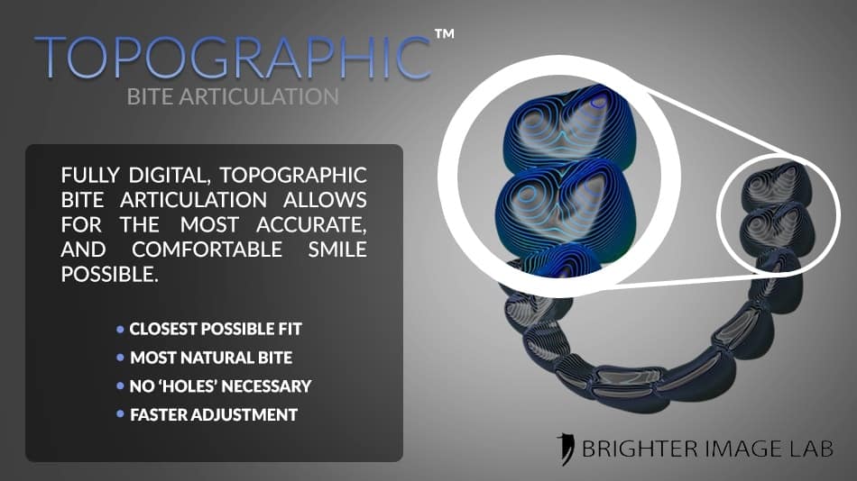 topographic-bite-articulation