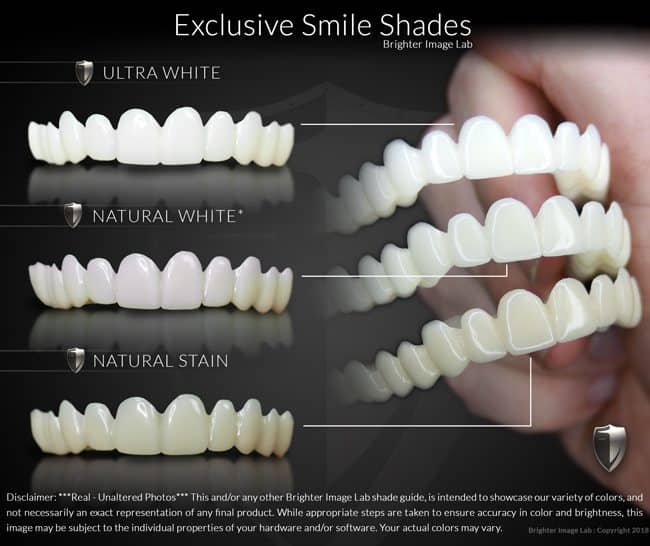 Exclusieve Smile Shades van Brighter Image Lab