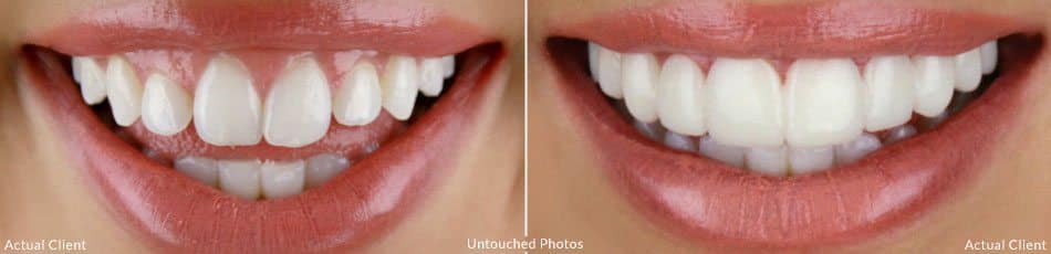 cosmetische tandheelkunde