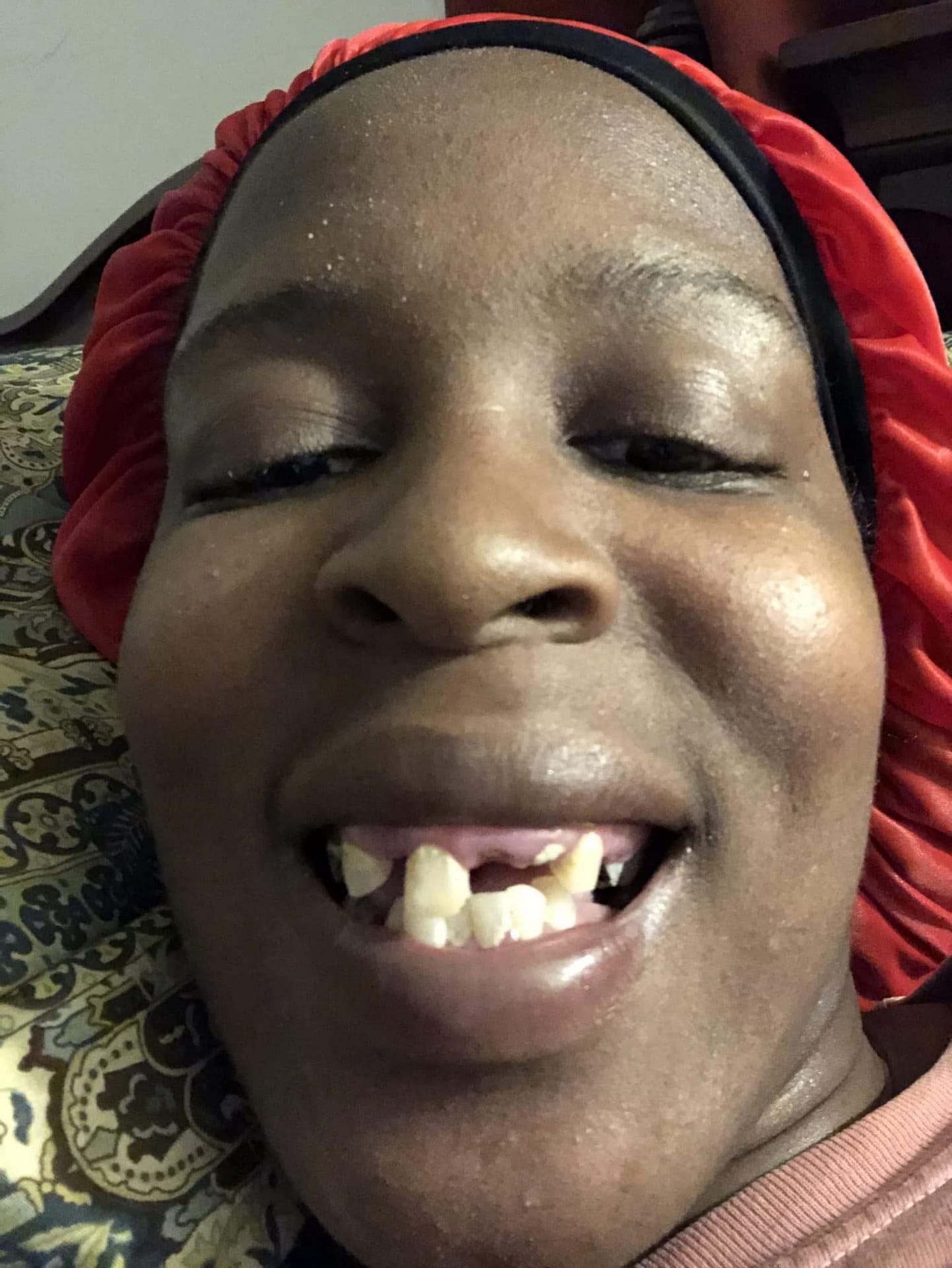 dents manquantes
