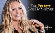 The Perfect Smile Makeover
