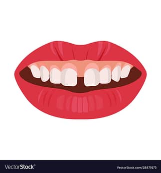 gap teeth