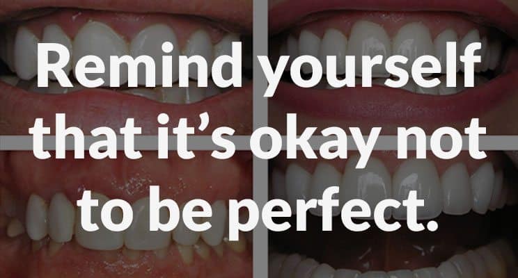 Traditional Dental Veneers: A Perfect Problem - Remind yourself that it's okay to not be perfect