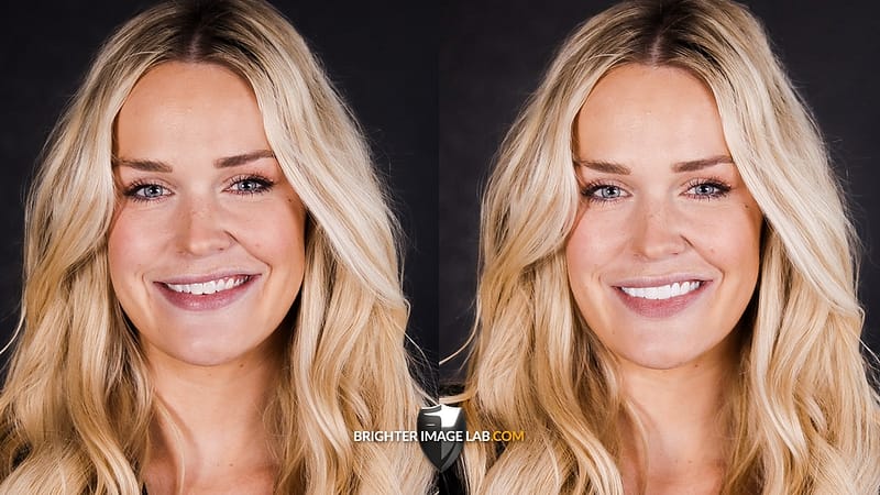 before-after-full-face.jpg