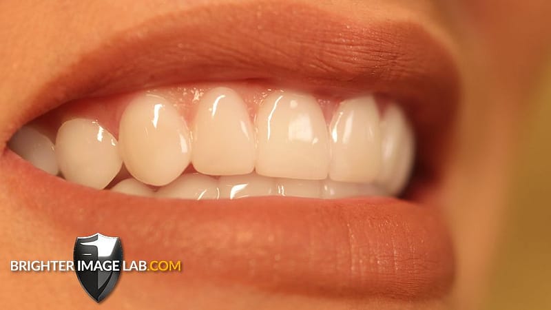 UK Home PressOn Veneers Brighter Image Lab Official Site BIL Veneers