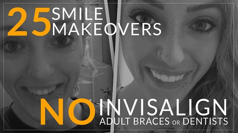 25 Amazing Before and After Smile Makeovers by Brighter Image Lab