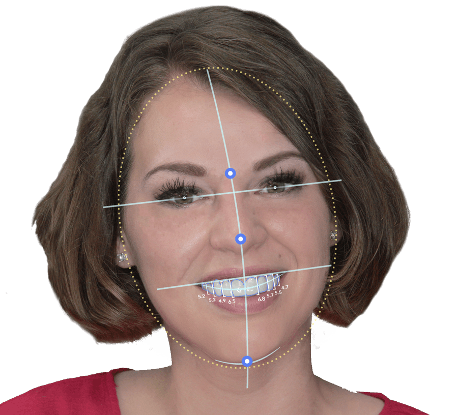 Facial Analysis Submission Complete PressOn Veneers Brighter Image