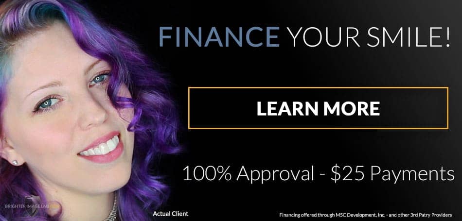 tooth contouring and dental veneer financing