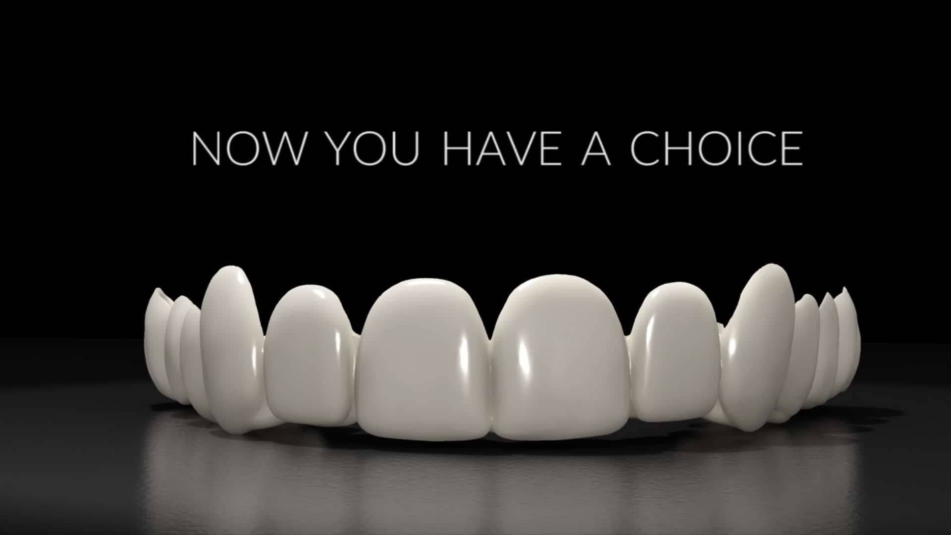 Removable Veneers - Now You Have A Choice