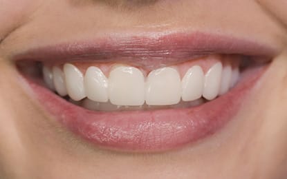 Brighter Image Lab Gapped Teeth Client After