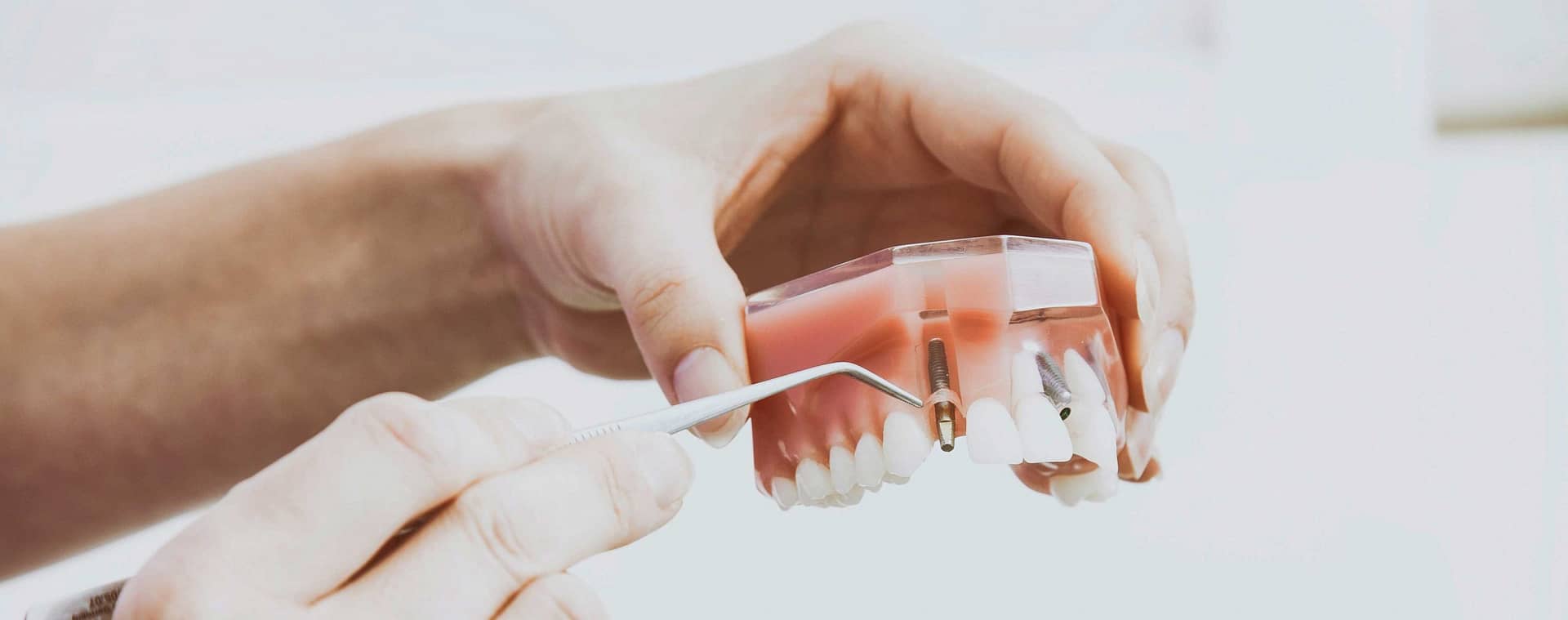 cosmetic-dentistry-screw